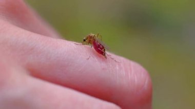 Sivrisinekler insan derisi üzerinde kan yiyor. Sivrisinek ısırığı. Makro, böcek vuruyor.
