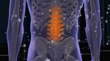 Acı dolu VFX Back Pain Arttırılmış Gerçeklik Animasyonunun animasyon geçmişi. Anatomi hastasını kapat