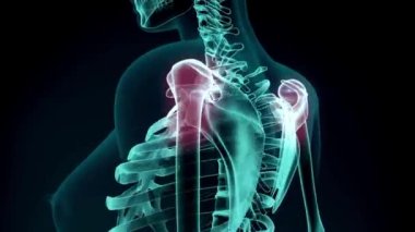 Acı dolu VFX Back Pain Arttırılmış Gerçeklik Animasyonunun animasyon geçmişi. Anatomi hastasını kapat