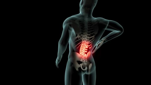 Mann Mit Rückenschmerzen Menschlicher Körper Wirbelsäule Vertebra Bewegungsanimation Gerendert — Stockvideo
