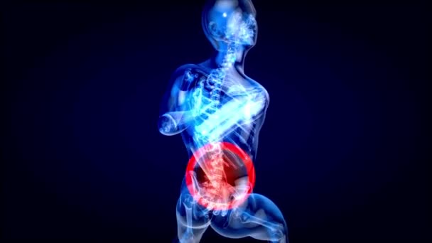Manusia Menderita Sakit Punggung Tulang Belakang Tubuh Manusia Vertebra Gerak — Stok Video
