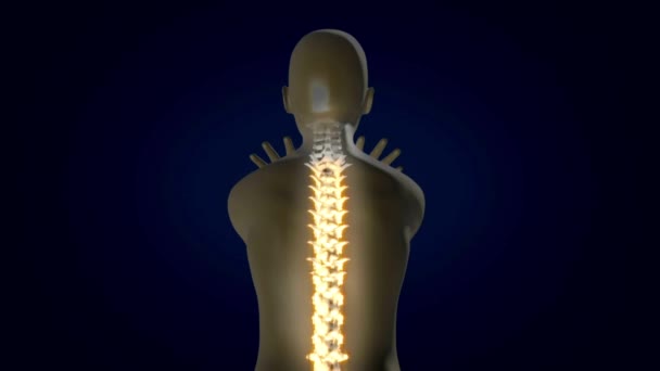 Medizinische Animation Der Schmerzen Der Unteren Rückenwirbelsäule Bei Menschen Mit — Stockvideo