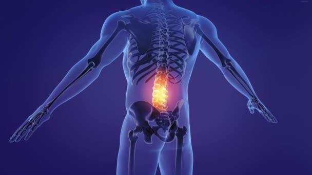 人类男性腰椎下部疼痛的3D动画治疗 — 图库视频影像