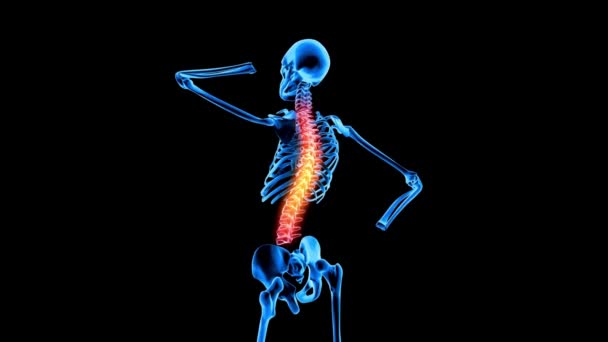 Mann Mit Rückenschmerzen Medizinische Animation Anatomie Konzept Rückenschmerzen Knochenskelett Röntgen — Stockvideo