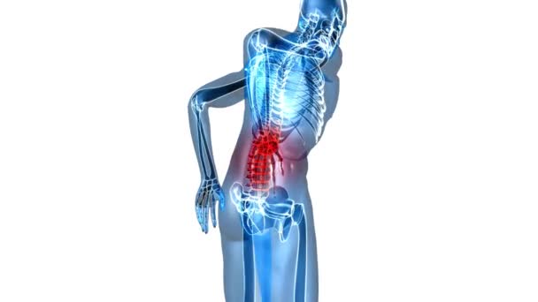 男子背痛3D医学动画4K解剖学概念背痛骨骼X光 — 图库视频影像