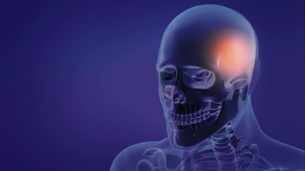 Mann Mit Rückenschmerzen Medizinische Animation Anatomie Konzept Rückenschmerzen Knochenskelett Röntgen — Stockvideo