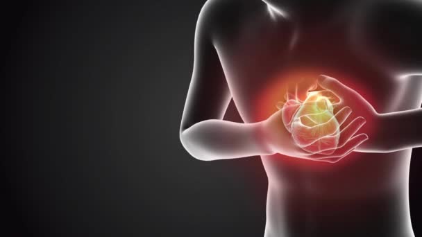 胸痛外傷性心疾患障害 X線回路図医療可視化 — ストック動画
