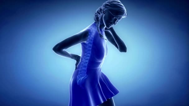 Schmerzen Der Unteren Rückenwirbelsäule Wirbelsäulentrauma Oder Arthritis Weibliches Menschliches Knochenskelett — Stockvideo