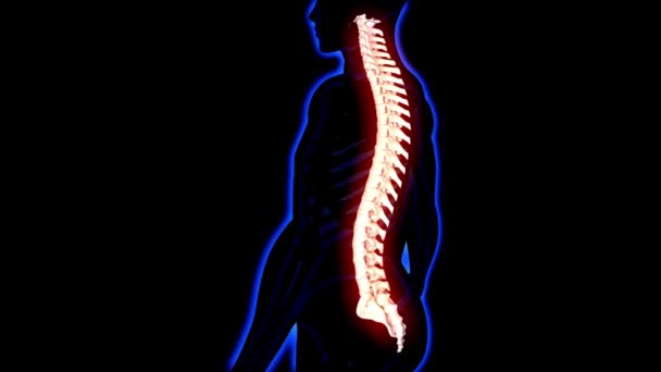 Animation Hintergrund Der Schmerzhaften Rückenschmerzen Vfx Rückenschmerzen Augmented Reality Animation — Stockvideo
