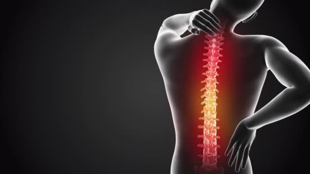 痛みを伴う背景Vfx腰痛拡張現実アニメーション 解剖患者を閉鎖する — ストック動画