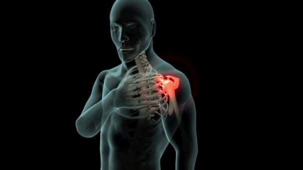 3Dレンダリングされた肩の痛みの医療アニメーションバック可視骨と透明人間の体 — ストック動画