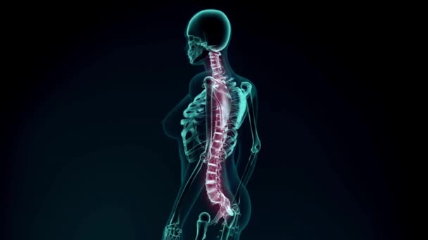 Animační Pozadí Bolestivých Zad Vfx Back Pain Augmented Reality Animation — Stock video