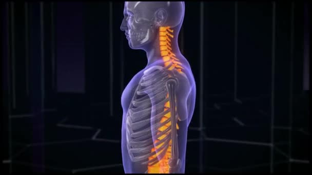 Medyczna Animacja Mężczyzny Ostrym Bólem Pleców Ludzka Anatomia Rentgenowska Urazy — Wideo stockowe