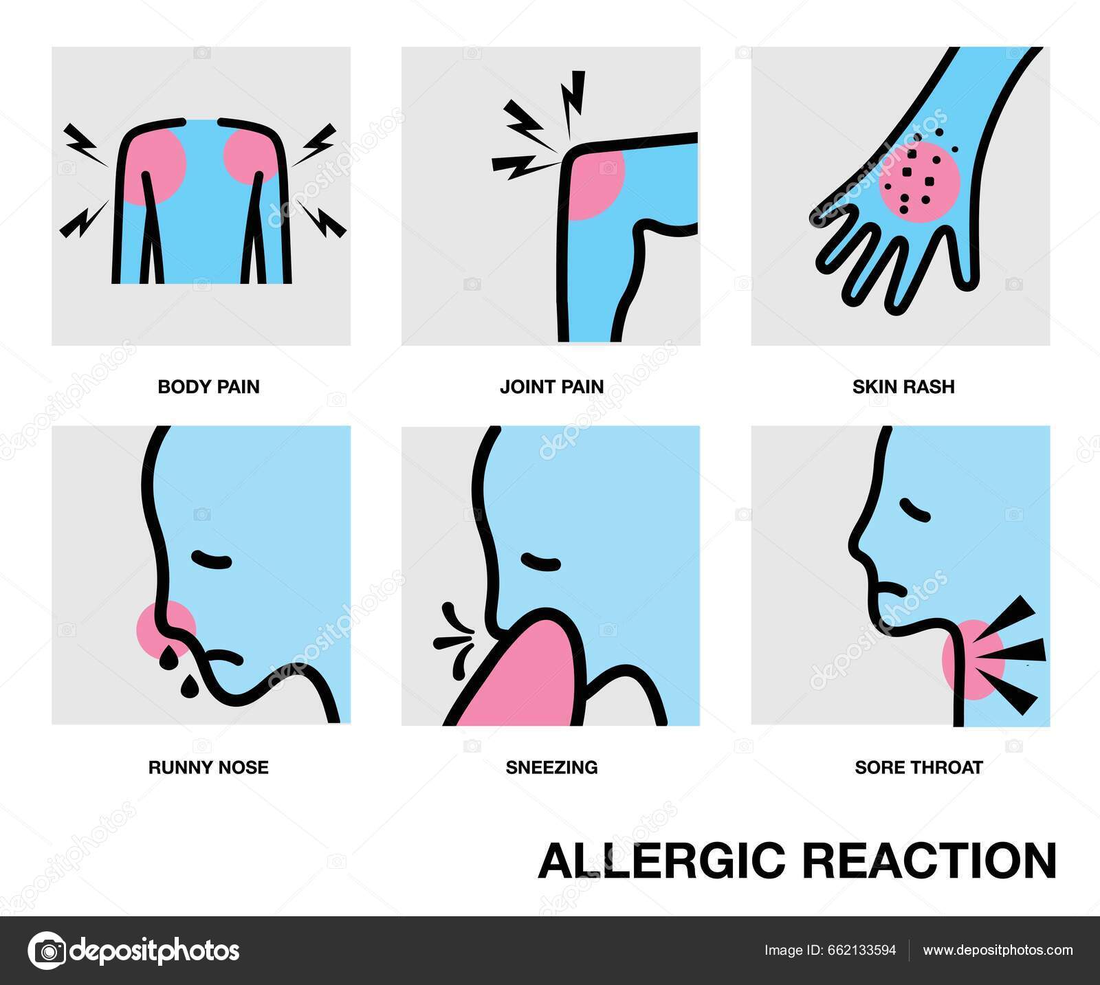 Allergic Reaction Drug Side Effects Itchy Skin Skin Rash Joint Stock