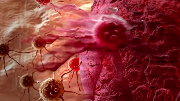 Καρκινοκύτταρα Υψηλές Λεπτομέρειες Κινουμένων Σχεδίων Παγκόσμια Ημέρα Καρκίνων Φεβρουάριος Concept — Αρχείο Βίντεο