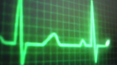 Animasyon kalp atış hızı monitörü - elektrokardiyogram. Kalp atış hızı monitörü, kalp atışı, kalp atış hızı..