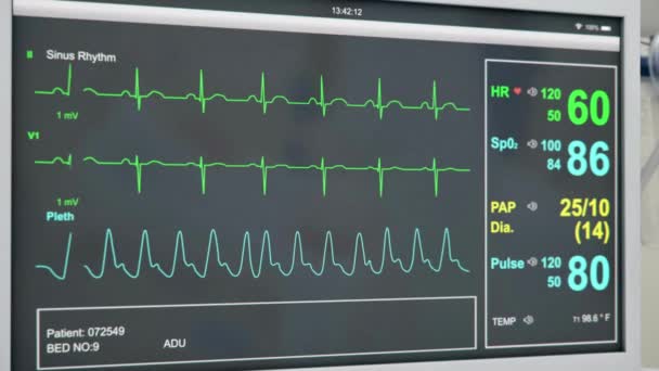 Ekg Kalp Monitörü Hastane Tıbbi Kontrol Hattı — Stok video