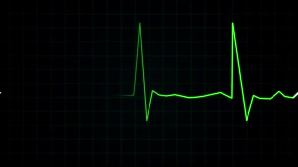 Flatline Ekg Projeto Movimento Monitoramento Cardíaco Vfx Projeto Hospital Emergência — Vídeo de Stock