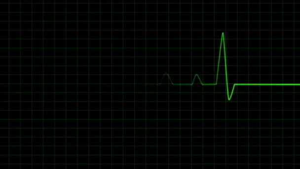 Icu Birimi Ndeki Ekg Monitörü Yoğun Bakımda Kalp Görsel Etkiyi — Stok video