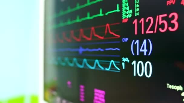 Animasyon Kalp Atış Hızı Monitörü Elektrokardiyogram Kalp Atış Hızı Monitörü — Stok video