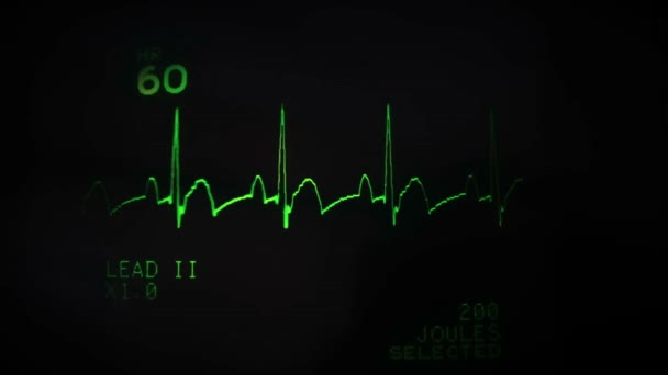 Ekg Kalp Monitörünü Kapat Flatline Hastane Makinesi Siyah Yeşil Çizgi — Stok video