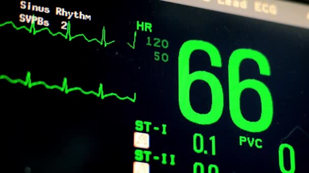 Zbliżenie Ekg Serce Monitor Płaska Linia Szpital Maszyna Ecg Czarny — Wideo stockowe