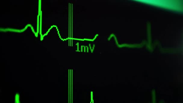 Acil Kalp Atışı Doktorluk Sağlık Yüksek Tedavi Izleme Hattı Dizaynı — Stok video