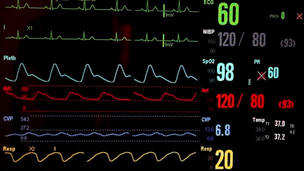 紧急心脏跳动医生药物健康高治疗Hd监测线路设计4K — 图库视频影像