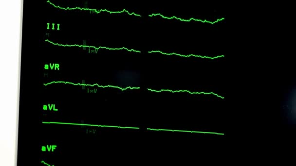 Cardiograma Batida Coração Projeto Mau Verde Conceito Hospital Linha Monitor — Vídeo de Stock