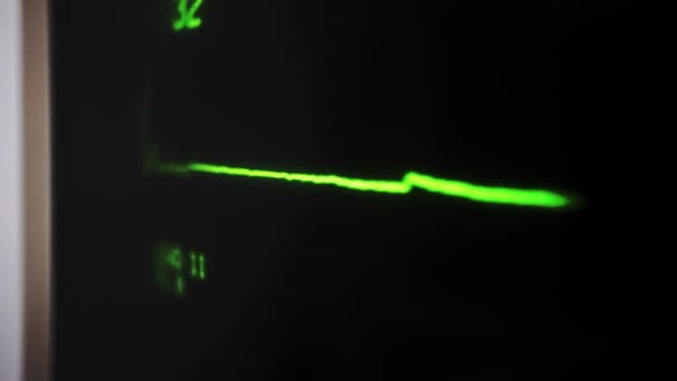 Puls Monitor Ekg Kardiogram Pętla Zielona Tętno Płaska Linia Tętno — Wideo stockowe