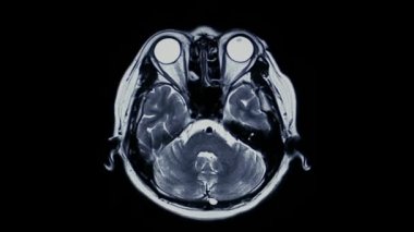 Beyin anatomisi anatomisi sağlık hastanesi sağlık sigortası tomografisini kapatın.