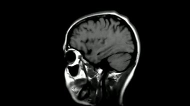 MRI beyin taraması. Manyetik rezonans. En iyi nöroloji veri analiz süreci.
