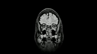 CT Beyin Taraması MR İnsan Anatomisi Hastalığı Sağlıklı yetişkin beyaz erkek araştırması