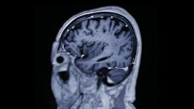 Beyin MRI kafa taramaları ve tümör tespiti siyah ve beyaz diyagnostik tıbbi araçlar