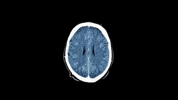 Close Tomografia Computadorizada Anatomia Cerebral Ciência Saúde Hospital Medicina Médica — Vídeo de Stock