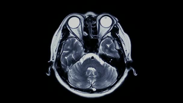 Primer Plano Tomografía Computarizada Anatomía Cerebral Medicina Médica Del Hospital — Vídeo de stock