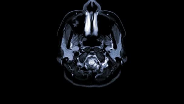 脑解剖学 健康科学医院医疗保健Ct扫描技术的研究 — 图库视频影像