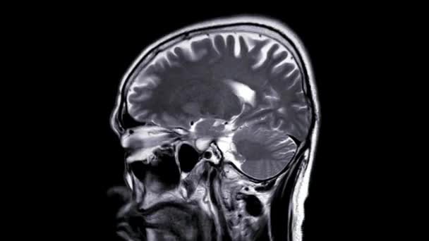 Menutup Scan Anatomi Otak Ilmu Kesehatan Rumah Sakit Medis Medis — Stok Video