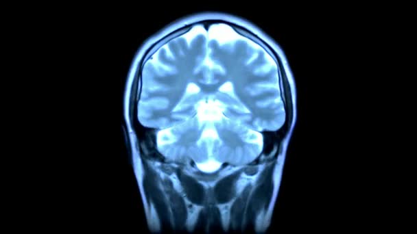 Detailní Záběr Skenování Mozku Anatomie Zdraví Věda Nemocnice Lékařství Zdravotní — Stock video