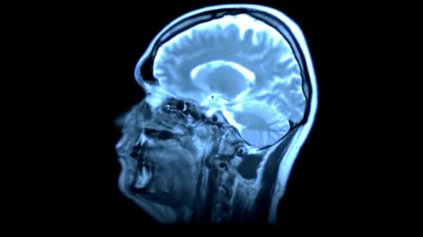Mri Human Brain Scan Concept Hospital Health Science Laboratory Medicine — Stock Video
