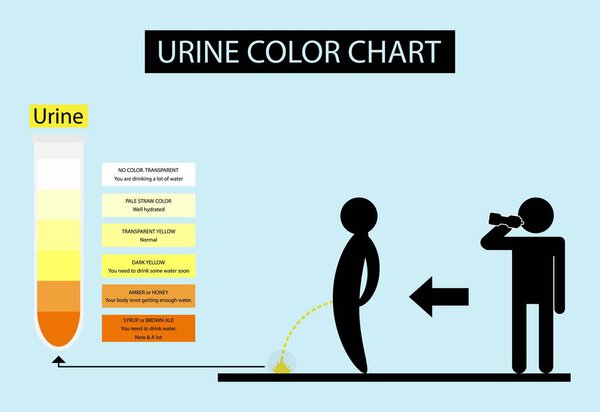 illustration of biology, Urine color chart, The color of urine can tell the health, Urine color chart, Light and dark yellow, amber, brown, and red urine, Medical test analysis