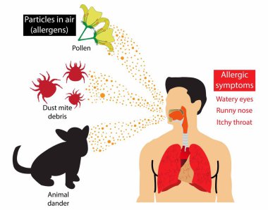 Tıbbi ve Kirlilik, havadaki alerji belirtileri, hava alerjisindeki partiküller, alerji, polen ve toz akarlarından kaynaklanan hava zehirlenmesinden kaynaklanır.