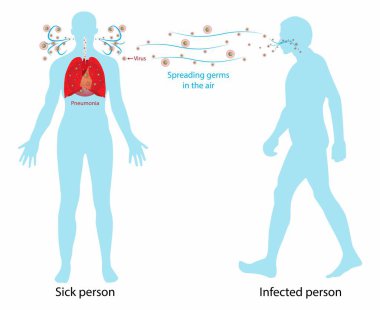 Biyolojinin ve tıbbın örnekleri, solunum yoluyla bulaşan virüsün enfekte olmuş bir insanın ağzından, öksürdüklerinde, hapşırdıklarında, konuşmalarında, nefes aldıklarında veya konuşmalarında veya konuşmalarında küçük sıvı parçacıklar halinde burunlarından yayılabilmesi.