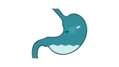 Mide bağırsağı ilaçla, kapsül ilaçla, çözünen ilaçla, insan midesi tedavisiyle, kapsül ilaçlarla, gastrit aşısıyla tedavi ediliyor.