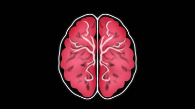 Beynin MRI taraması, beynin manyetik rezonans görüntülemesi, tomografi, beyin taraması bölümü, klinikteki insan beyninin MRI taramasıyla nörolog, tasarım için Banner.