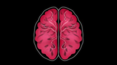 Beynin MRI taraması, beynin manyetik rezonans görüntülemesi tomografi, beyin taraması, beyin çapraz bölümü, klinikte insan beyninin MRI taramasıyla nörolog, tasarım için Banner.