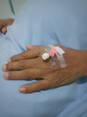 Cannula yaşlı bir adamın içine yerleştirilmiş. Eline serum takmak için kullanılan bir bant takılmış. Üzerinde cerrahi bir bez var.