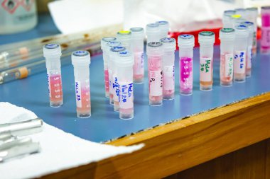 Sıvı nitrojen infüzyonundan alınan kriyovial tüplerdeki kanser hücrelerinin yakın çekim kültürleri laboratuvarda kanser karşıtı ilaç testleri için hazırlanıyor. Araştırma ve uyuşturucu geliştirme, Tıbbi, İlaç, Biyokimya. 