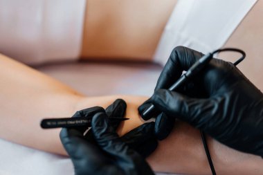 Doktorun yakın görüntüsü, elektro iğne ve cımbız kullanarak hastaya elektroepilasyon yapmaktır. Saç çıkarma prosedürü, profesyonel güzellik hizmetleri. Güzellik uzmanları eldiven giyer. Yüksek kalite fotoğraf