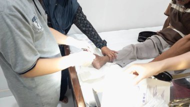 Pinrang Endonezya 24 Ekim 2023: Bedah Minor, Onychomycosis, tırnakların Paronychia mantar enfeksiyonu, cerrah çalışma odasında mantar enfeksiyonunun cerrahi müdahaleyle alınması. TÜRKÇE